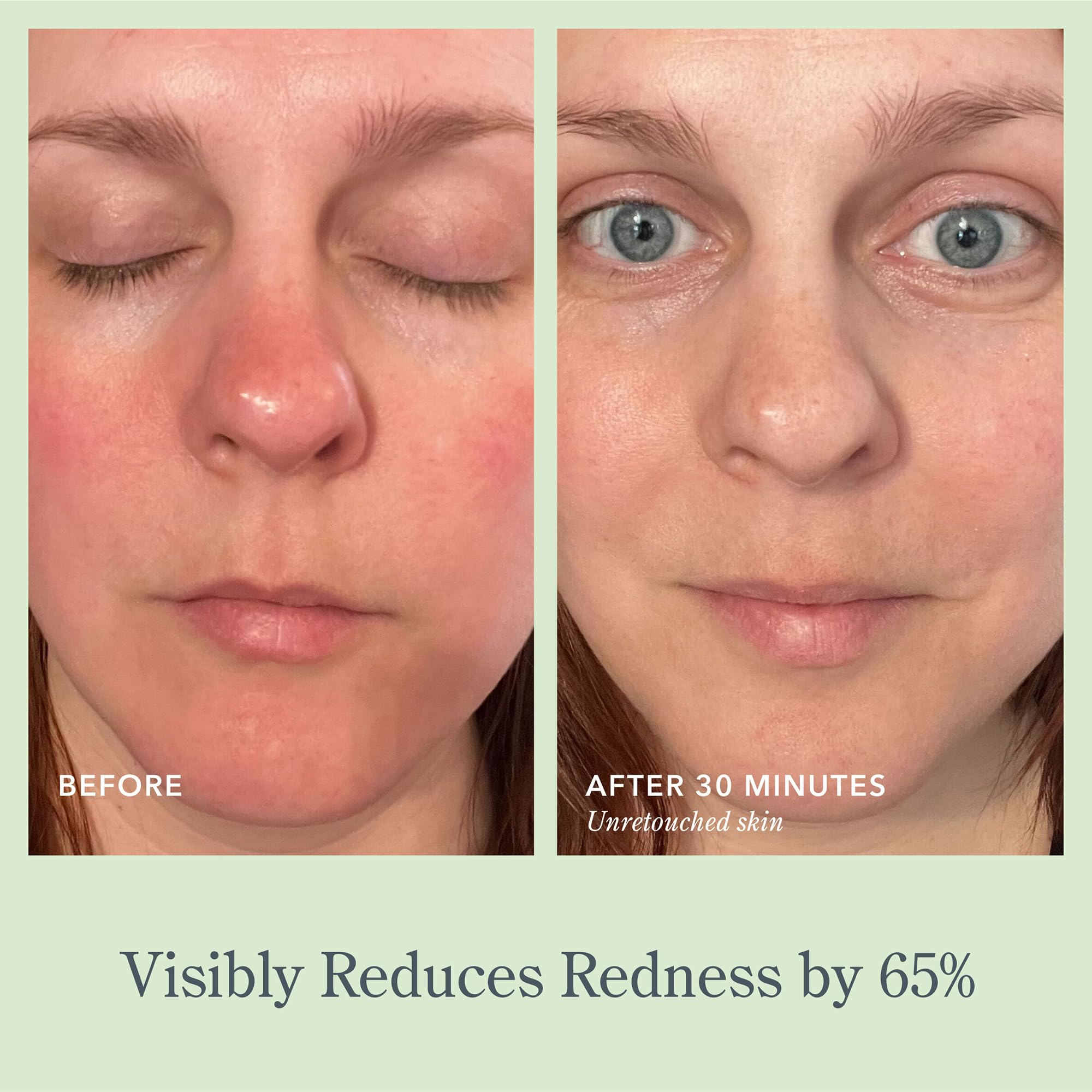 Fragrance-free icon signals a fragrance-free formula for sensitive skin.