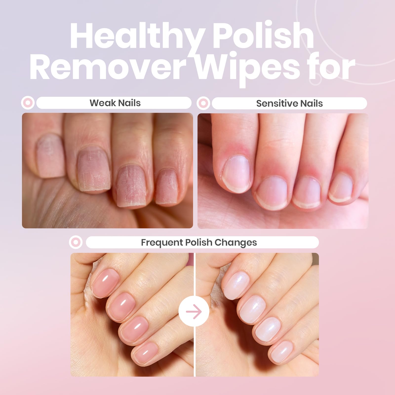 Beetles Non-acetone remover formula protects sensitive skin during removal