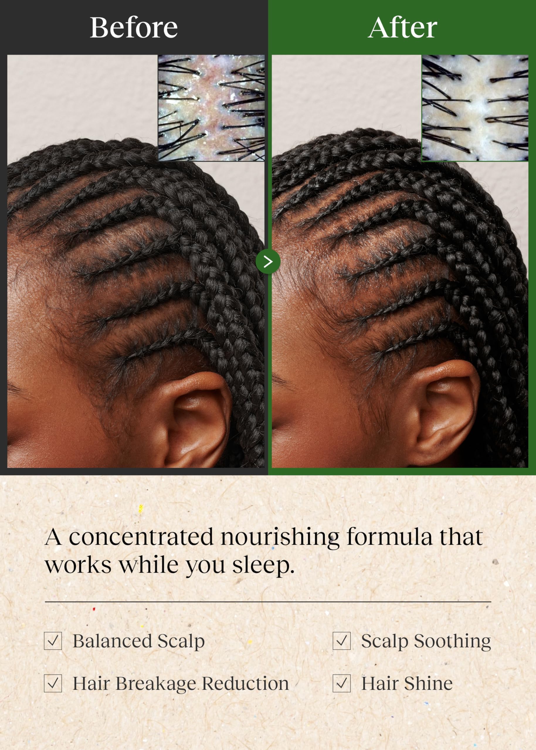 Bephor Braid Rev Scalp Balm massage scene, relaxing bedtime ritual.