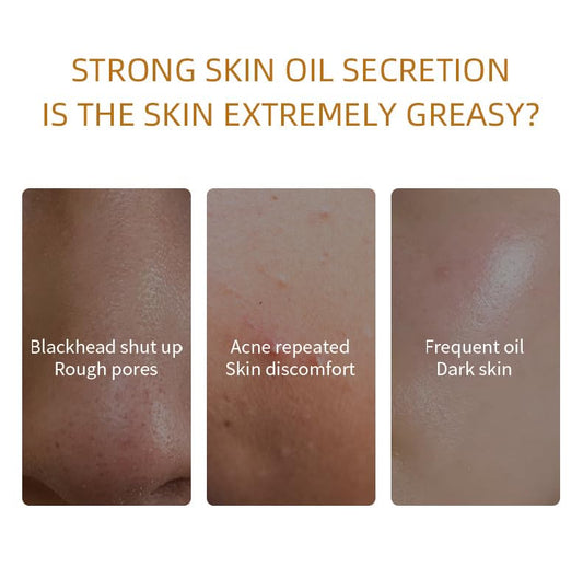 BERVEAL clay mask green tea focus suggests soothing, refreshing care