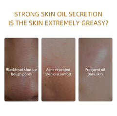 BERVEAL clay mask green tea focus suggests soothing, refreshing care
