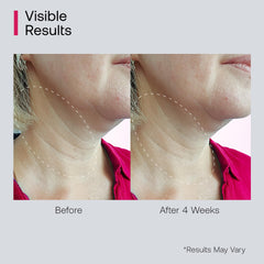 Bestkiss decollete area treatment highlights targeted care for chest lines
