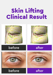 bewants two-pack eye serum set for daily use and travel