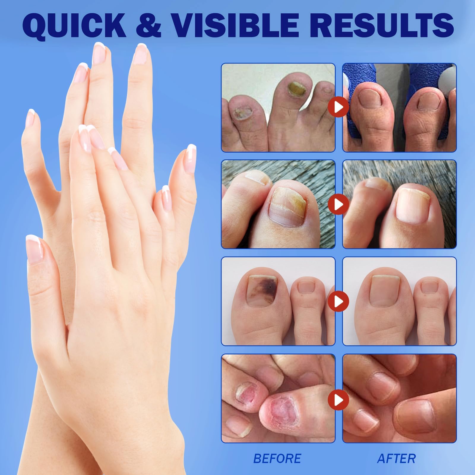 BFGCKJ 21-count pack provides long-term options for ongoing nail care