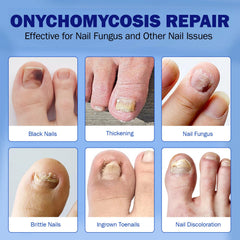 BFGCKJ patch applied to toe with calm bedtime routine
