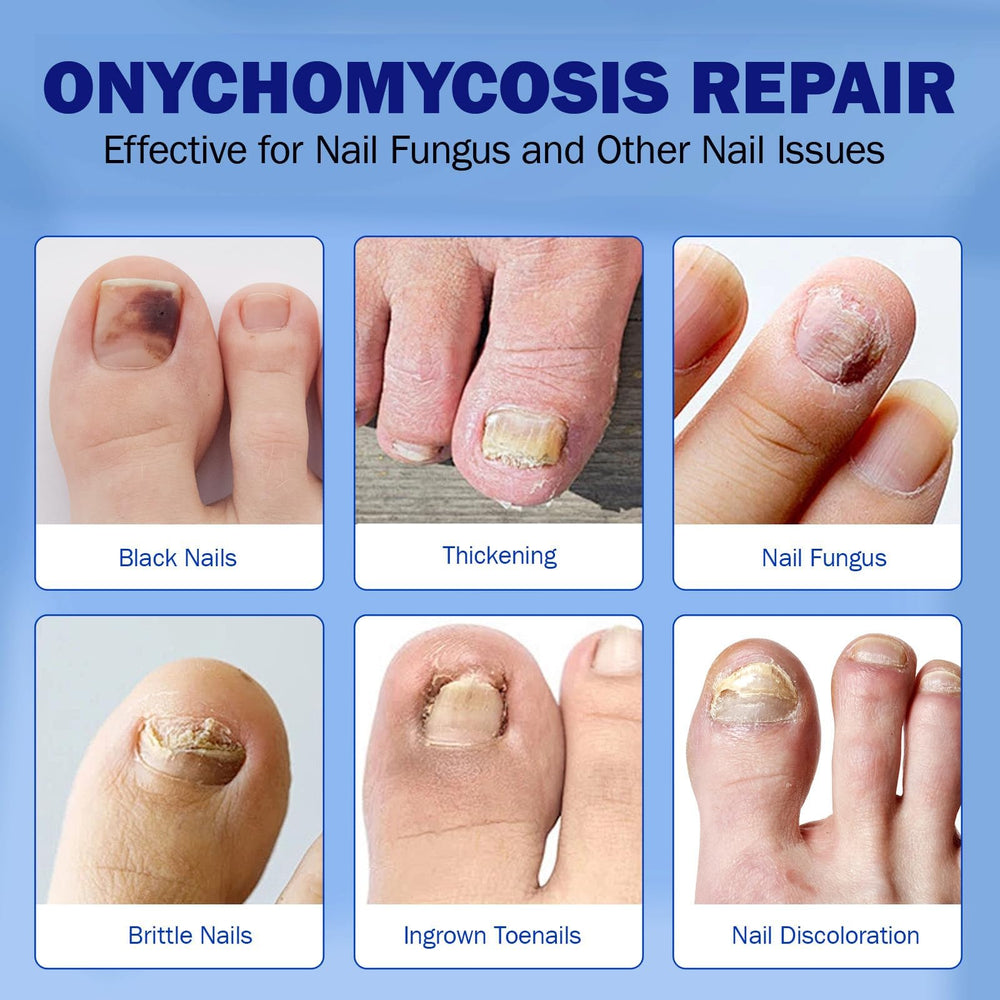 BFGCKJ nightly-care routine supports consistent use for healthier-looking nails