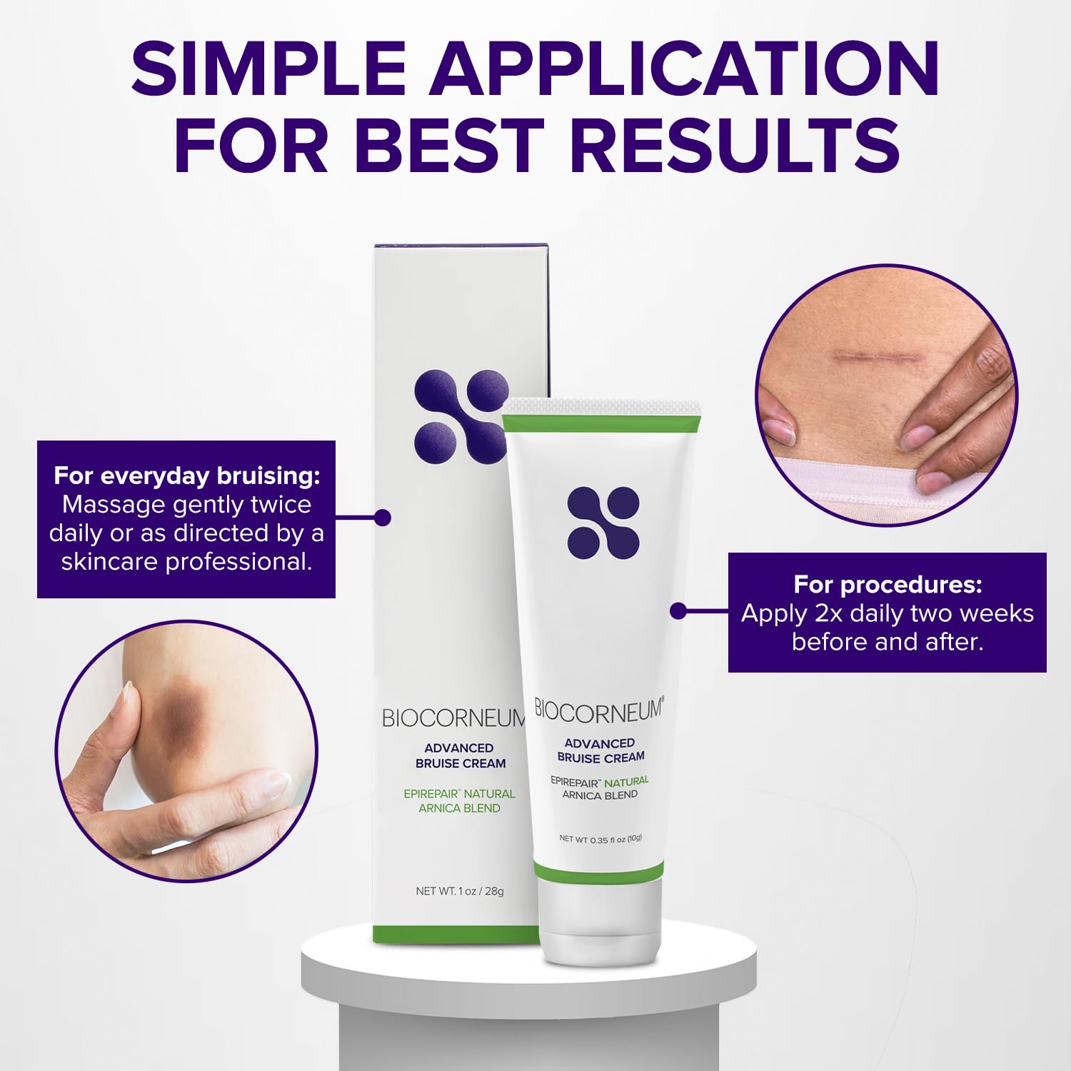 BIOCORNEUM Advanced Bruising Cream packaging close-up for premium branding.