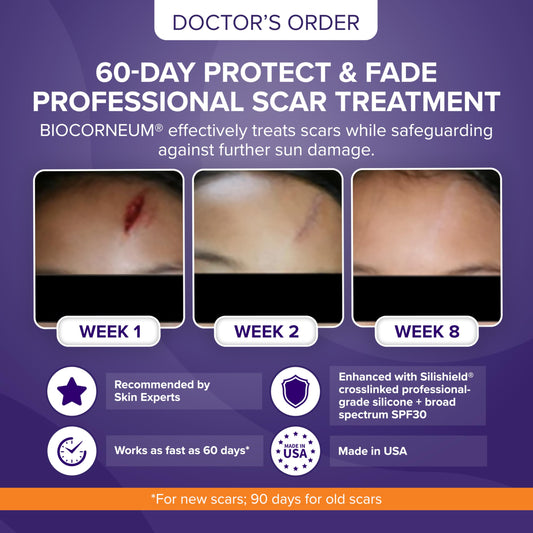 BIOCORNEUM SPF 30 sun protection for scar care and even tone.