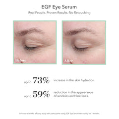 Chilled Bioeffect EGF Eye Serum provides added relief for puffy eyes.