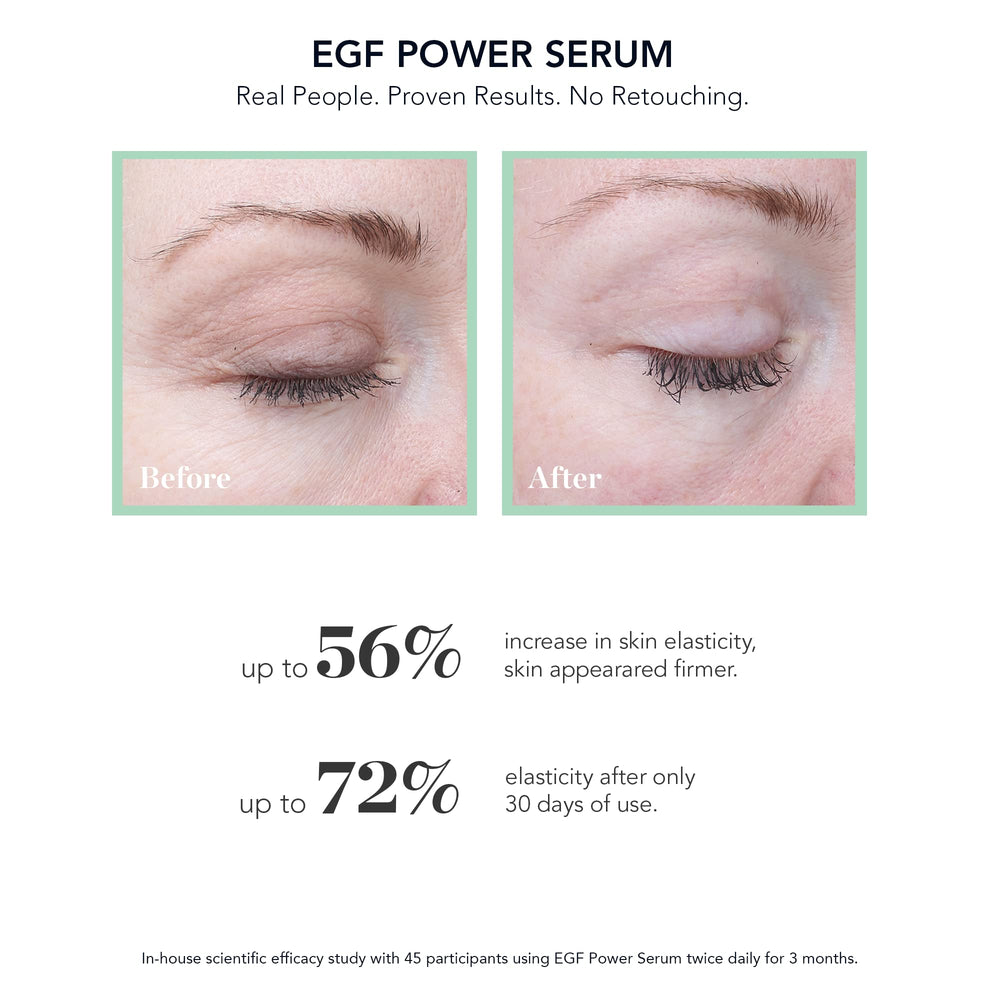 BIOEFFECT EGF Power Serum applied to skin suggests firming and subtle plumping.