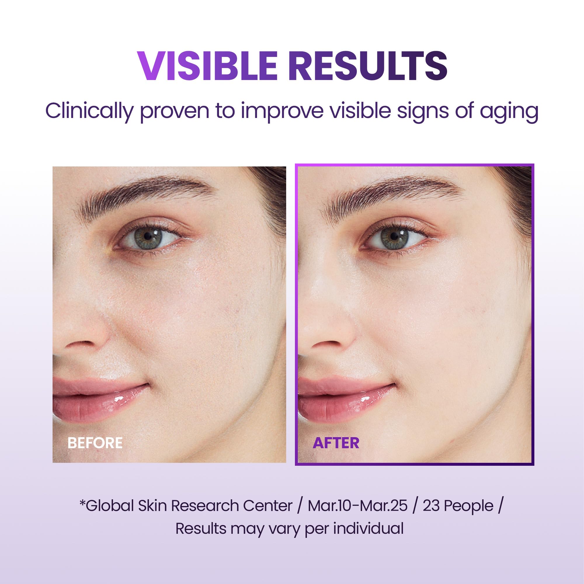 BIOHEAL BOH Probioderm 3D Lifting Cream Mask sheet-application on skin suggests immediate hydration