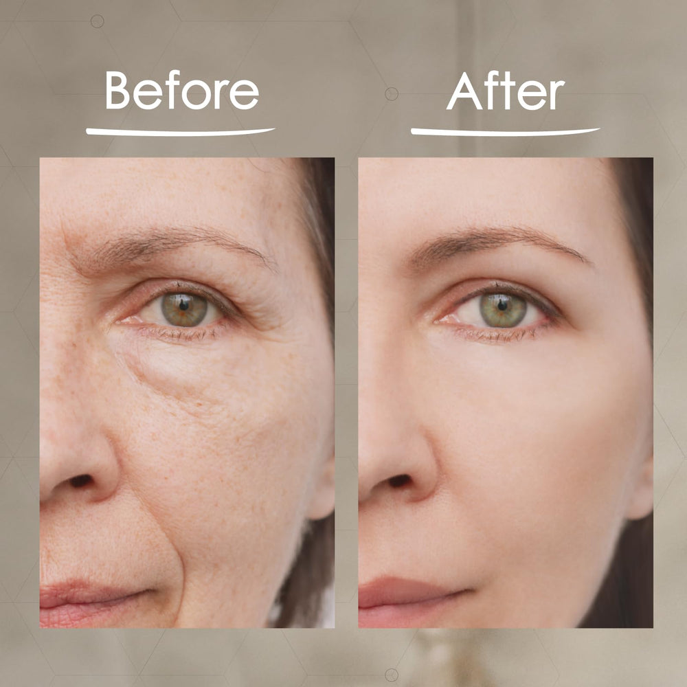 BioLogic Solutions MaxiLift Serum before-after example suggesting visible difference.