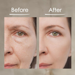 BioLogic Solutions MaxiLift Serum before-after example suggesting visible difference.