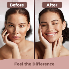Bionyx Rhodium Complex used on face and neck for uniform exfoliation.