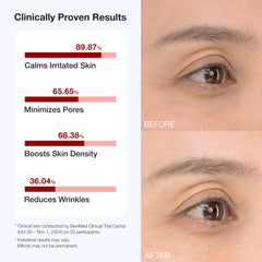 BIOOA PDRN Teedle Shot 300 micro-needling feel on skin for improved texture