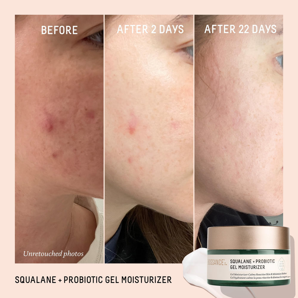 Close-up of BIOSSANCE gel texture reveals a smooth, non-greasy finish