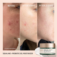 Close-up of BIOSSANCE gel texture reveals a smooth, non-greasy finish
