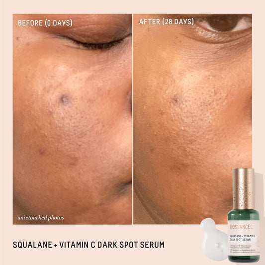 BIOSSANCE Squalane + Vitamin C serum texture on the skin delivers lightweight hydration.