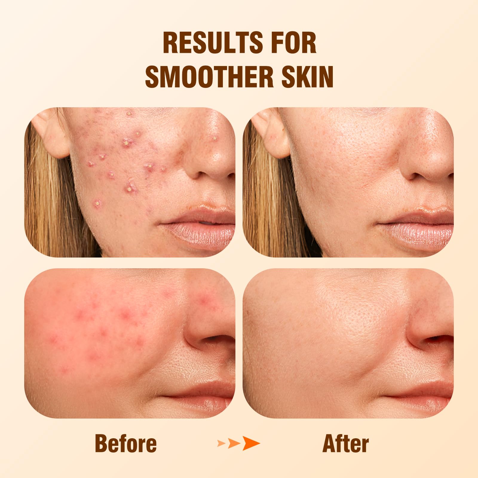 BIYSBER Salicylic Acid Serum texture close-up highlighting pore refinement