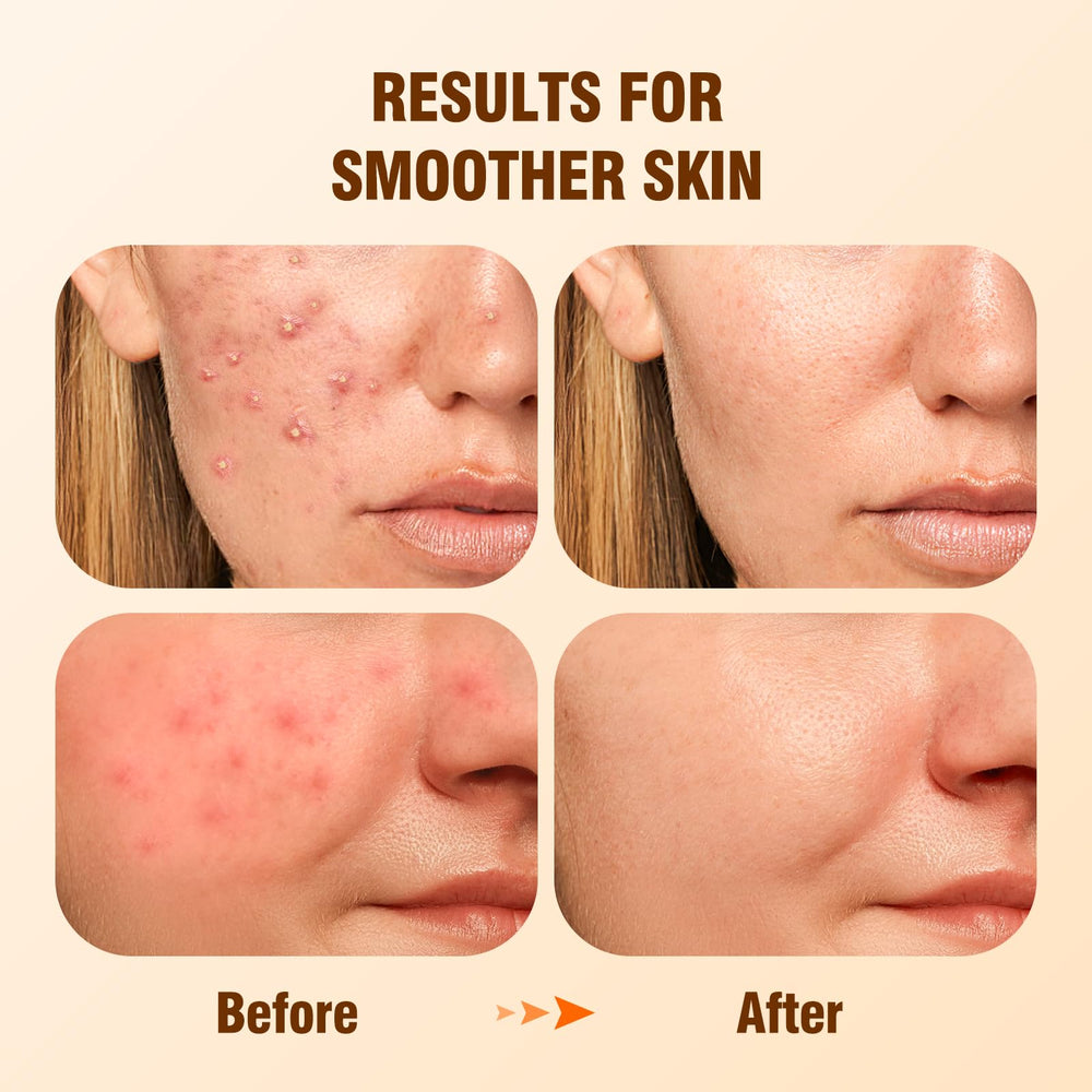 BIYSBER Salicylic Acid Serum texture close-up highlighting pore refinement