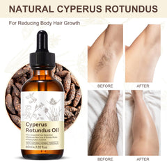 BKKTfBWK Cyperus Rotundus Oil after hair removal helps calm irritation