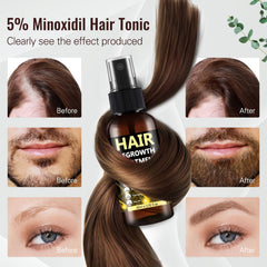 BLISSMATE minoxidil spray on scalp supports thinning hair with targeted care.