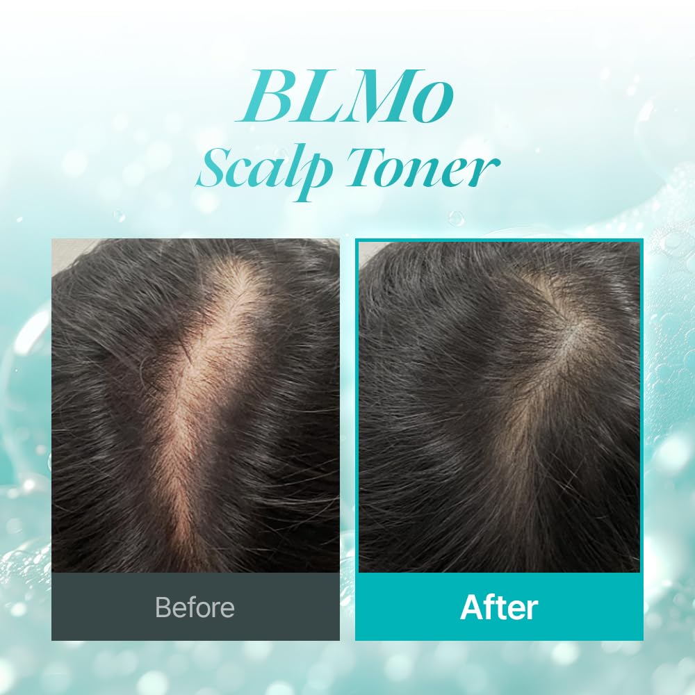 BLMo scalp toner drops applied for mess-free, even root coverage