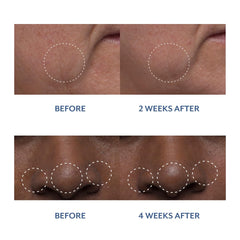 Bloomeffects Tulip Dew Drops droplet being dispensed indicates easy, precise application