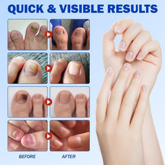 BOELIKAYS long-term use promoting healthier-looking nails