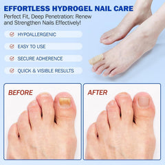 BOELIKAYS patch showing reduction in nail discoloration
