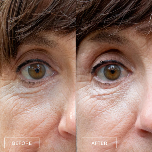 Boom Awaken eye cream with Vitamin C brightens and evens tone over time.