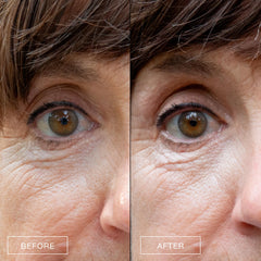 Boom Awaken eye cream with Vitamin C brightens and evens tone over time.