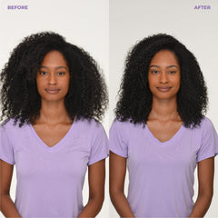 BosleyMD Saw Palmetto bottle signals DHT defense to reduce shedding.