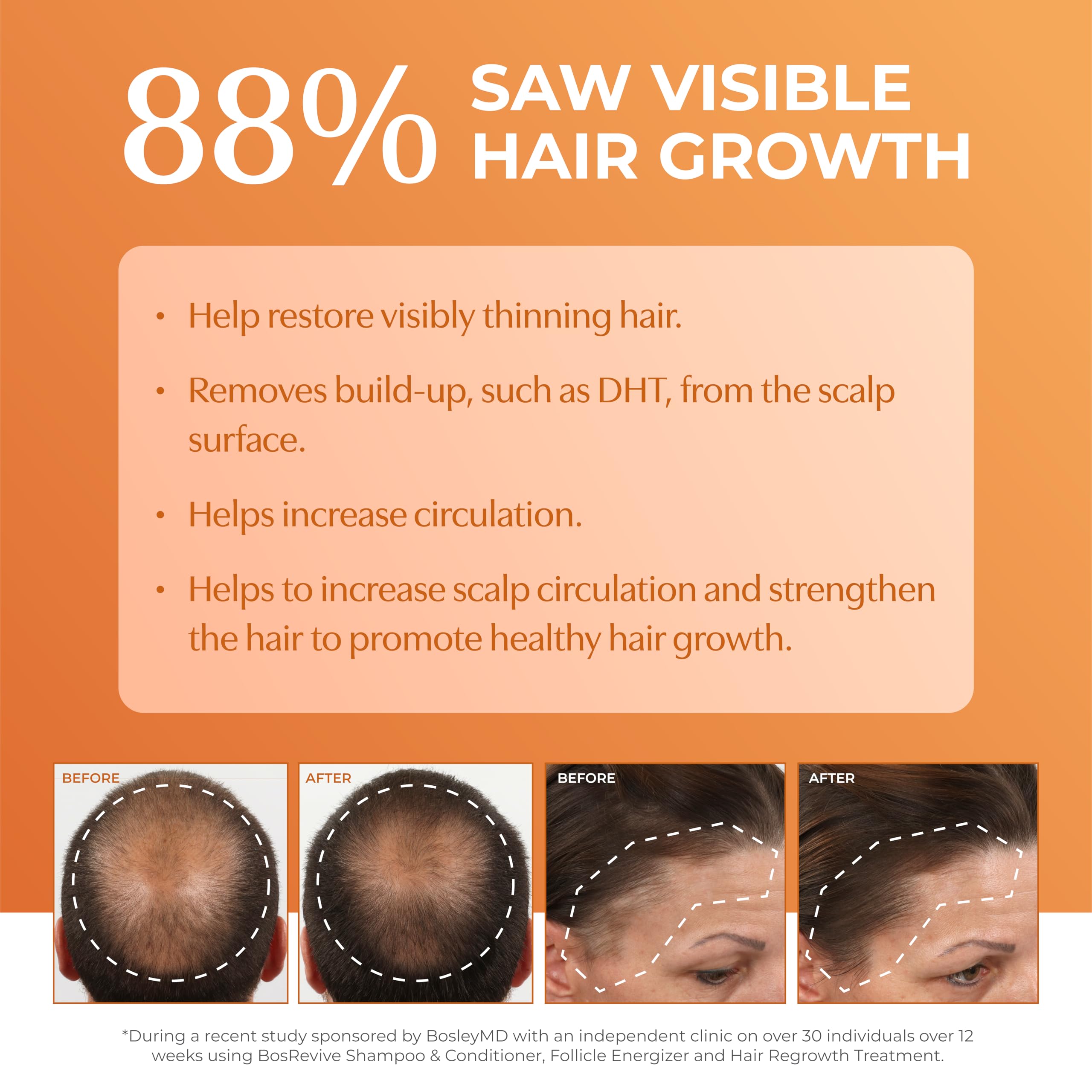 BosRevive saw palmetto extract ingredient close-up for scalp care
