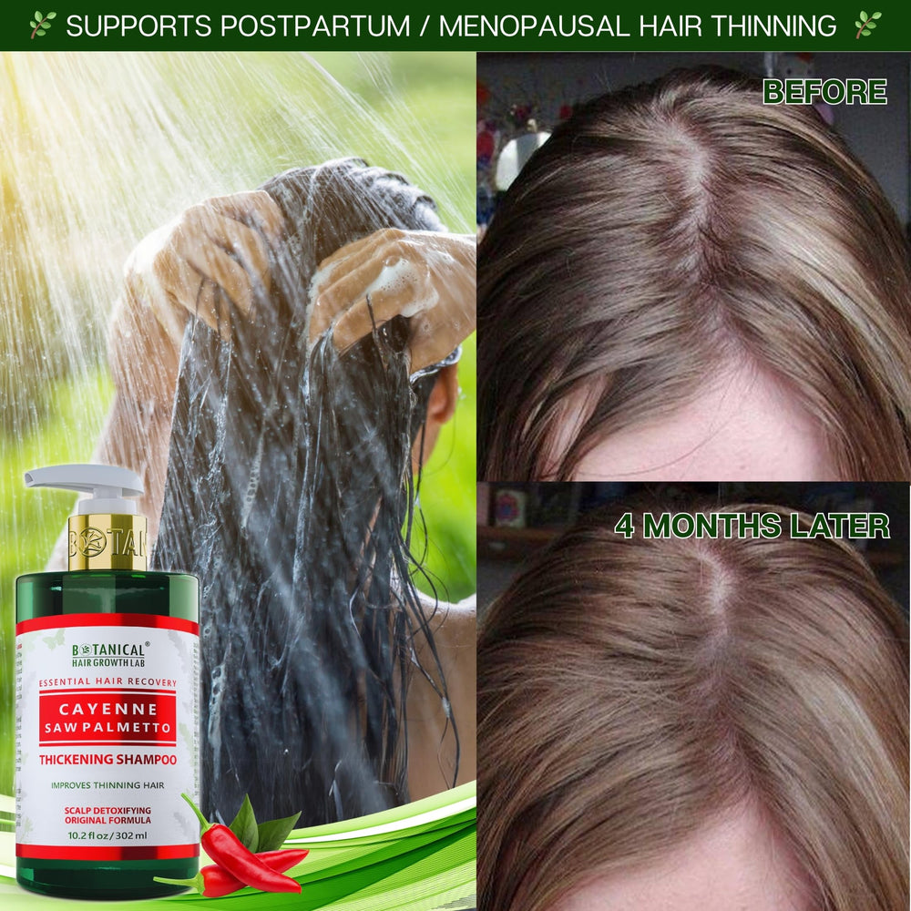 BOTANICAL HAIR GROWTH LAB daily-use bottle ready for routine care.