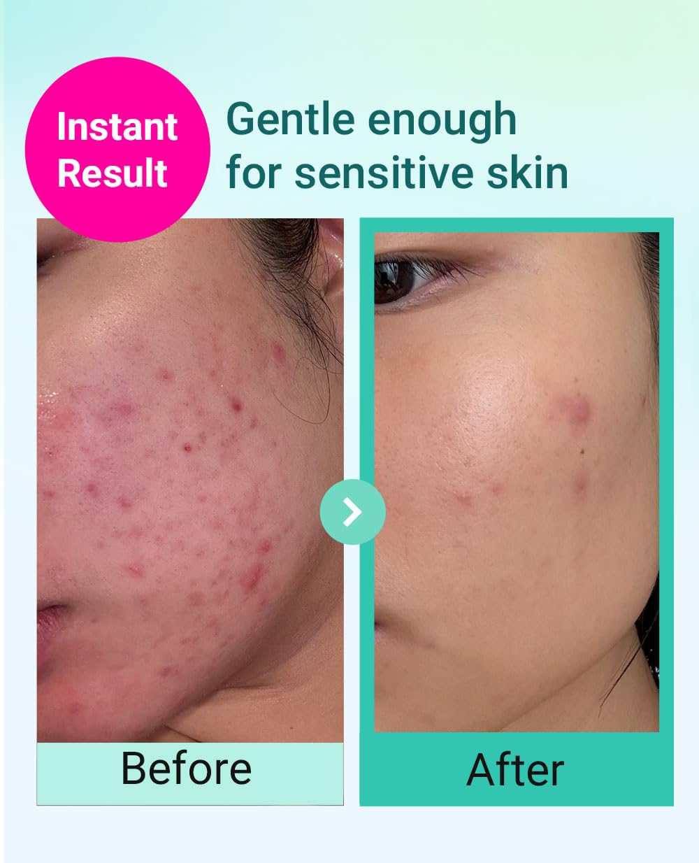 Bring Green deep cleansing foam lather close-up for clear pores