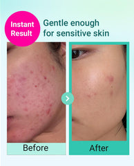 Bring Green deep cleansing foam lather close-up for clear pores