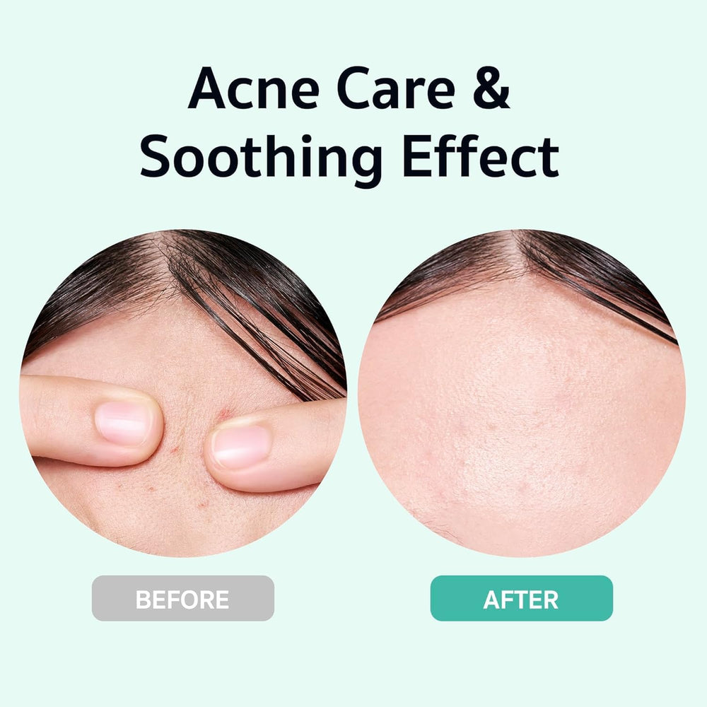TeCa Liposome soothing formula close-up for gentle nourishment.