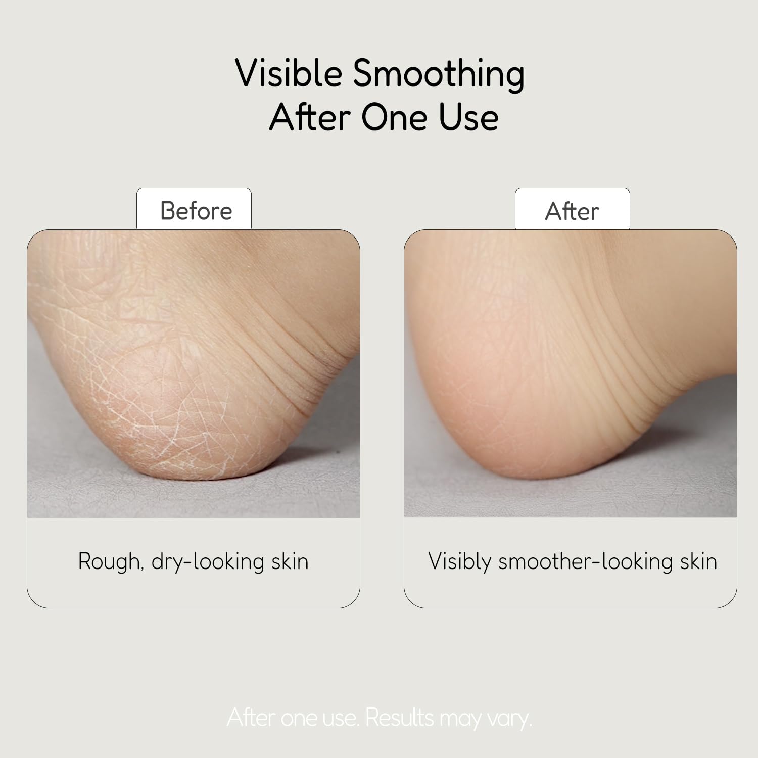 BuffOut being rubbed on a dry heel for gentle exfoliation.