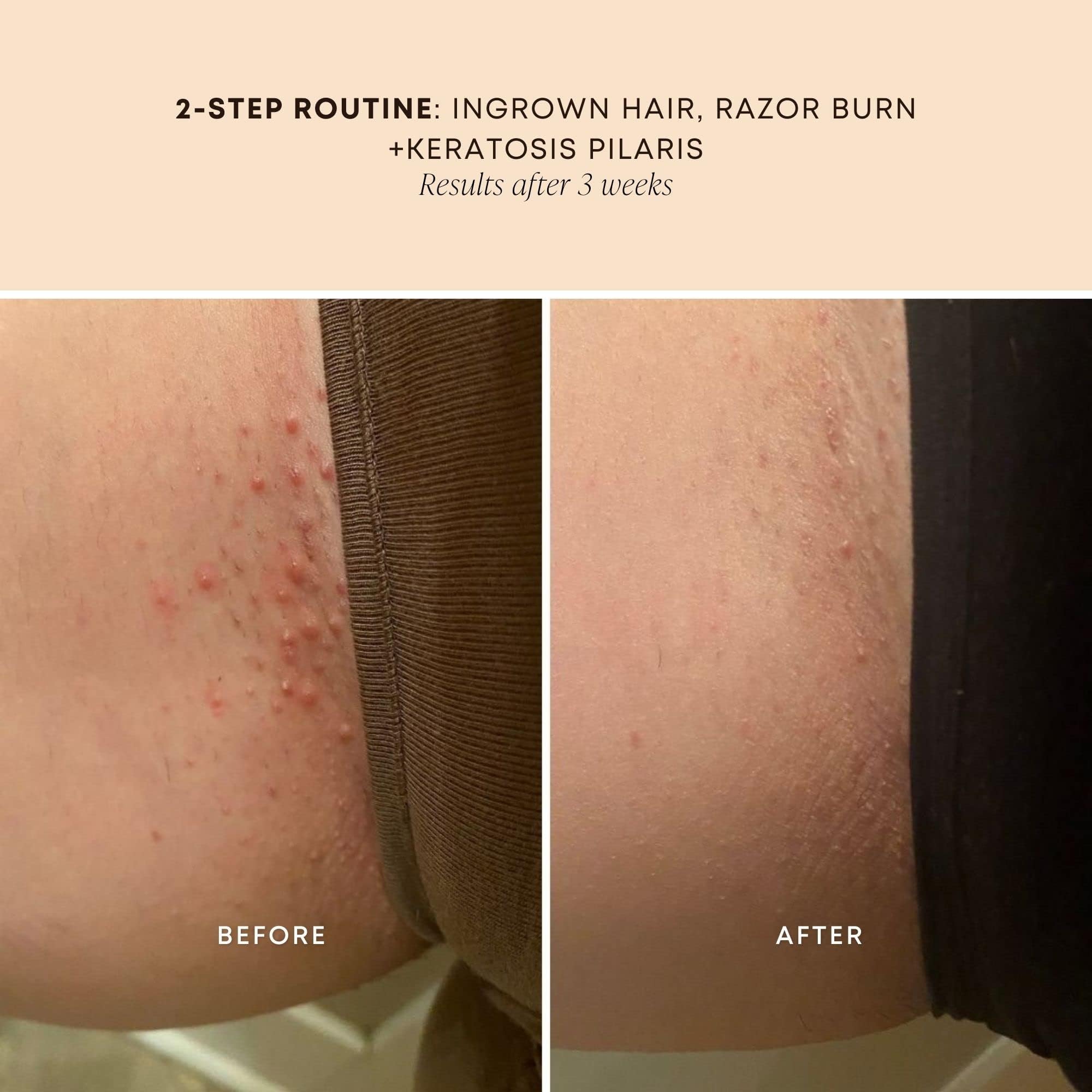 Gentle massage on skin demonstrates hydration without greasiness.