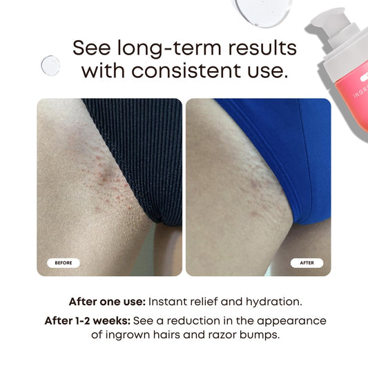 Bushbalm Watermelon Sugar Scrub 236 ml jar exfoliates and hydrates for smoother skin.