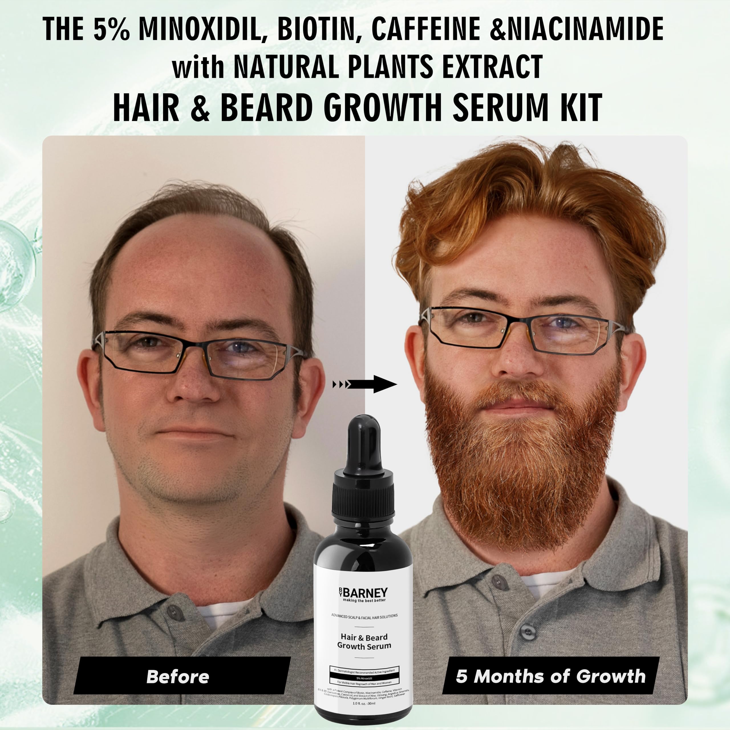 BY BARNEY Beard growth serum application on facial hair for fuller look.