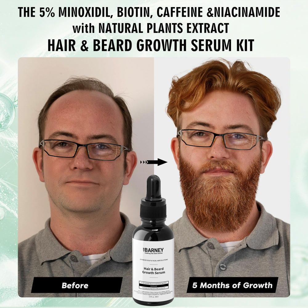BY BARNEY Beard growth serum application on facial hair for fuller look.