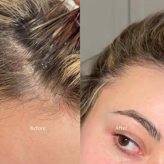 By Veira Sensitive Conditioner pump usage shows gentle daily care.