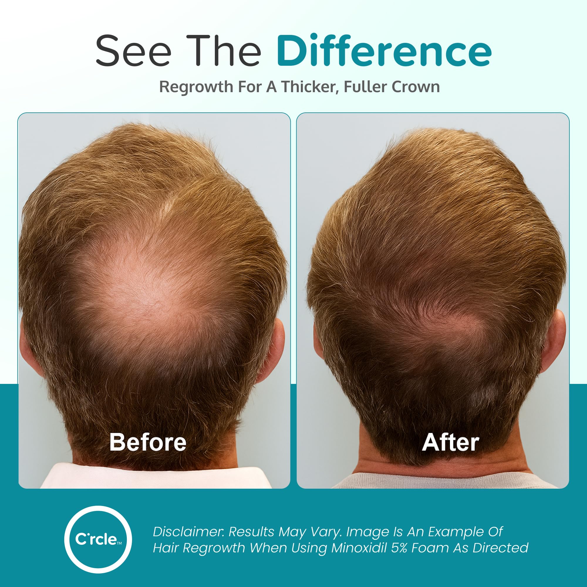 Smooth texture of C'rcle Minoxidil 5% Foam absorbed quickly into the scalp