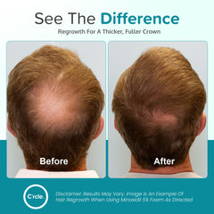 Smooth texture of C'rcle Minoxidil 5% Foam absorbed quickly into the scalp