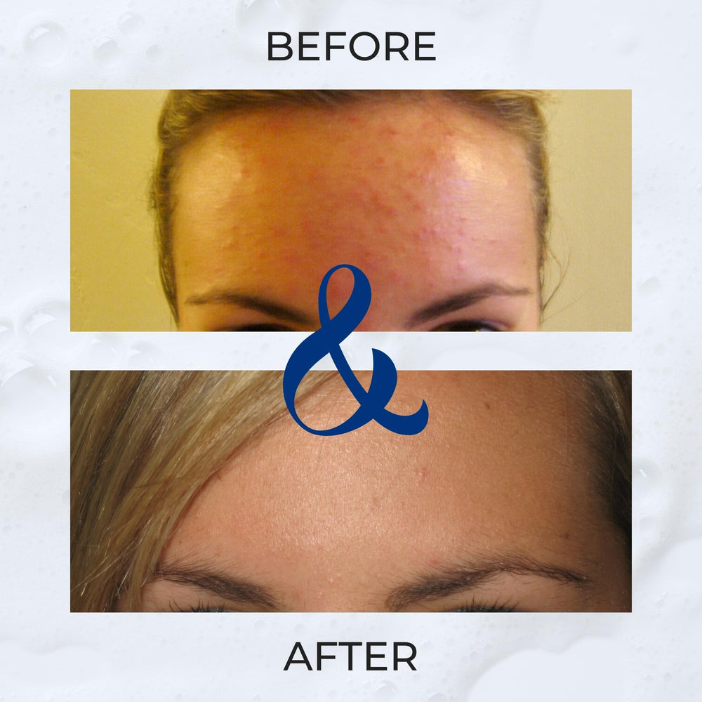 C2P wet hair rinse action emphasizes gentle cleansing