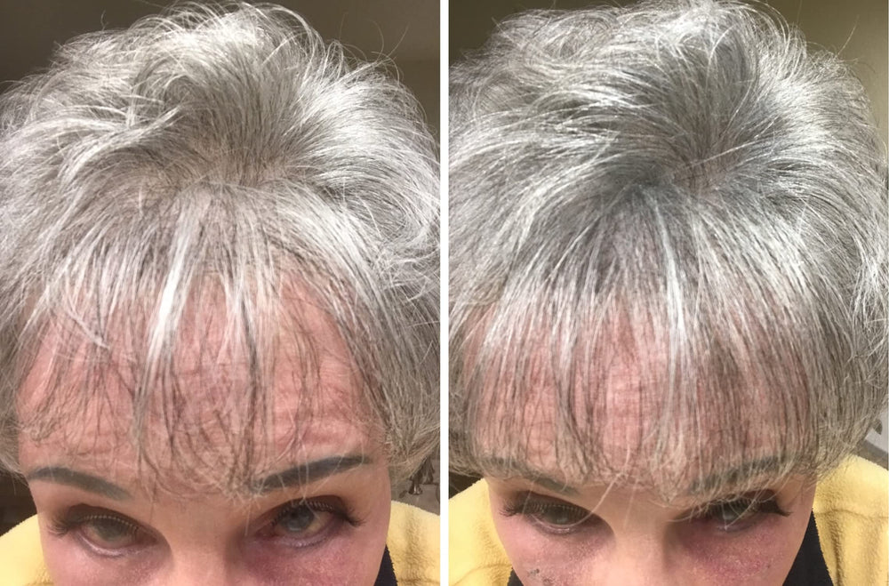 Caboki easy application—shake and pat for quick coverage.