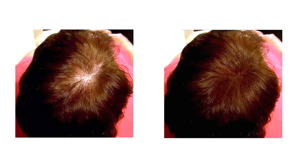 Caboki Auburn application-dusting demonstrates easy, mess-free use.