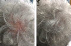 Applying Caboki on the scalp in a thinning area to blend hair.